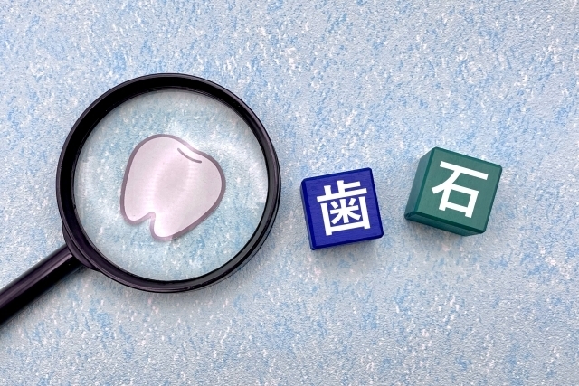 歯石取り